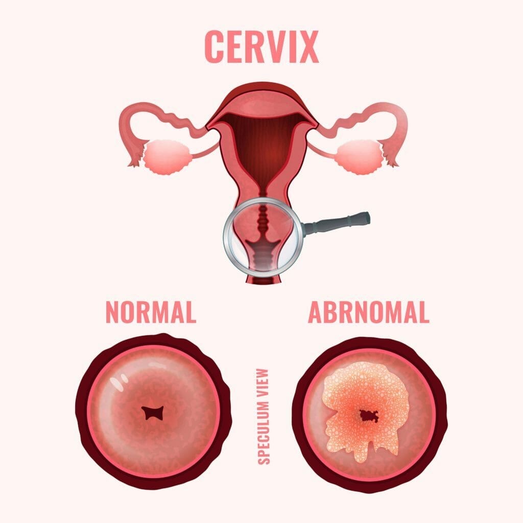 January Intentions Getting to Know your Cervix Aspivix