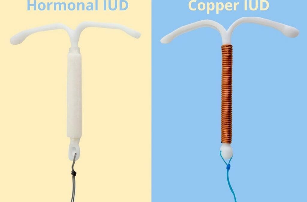 Hormonal-Copper-IUD-1024x768-1-1024x675